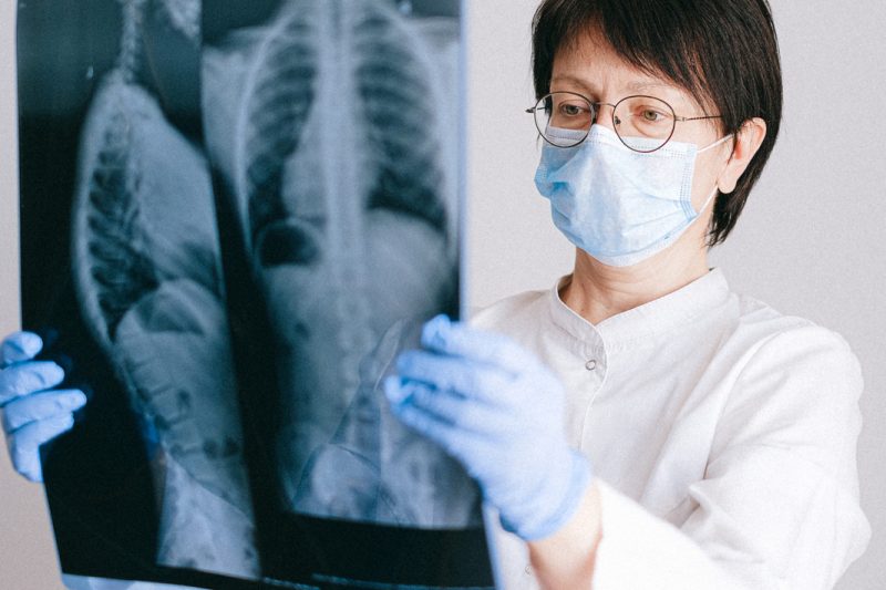 Chiropractor analyzing X-rays to develop a treatment plan using the Gonstead Chiropractic Technique.
