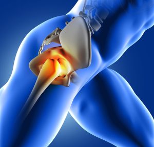 chiropractic care for hip pain