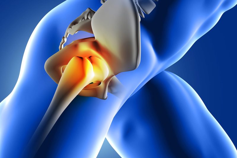 chiropractic care for hip pain