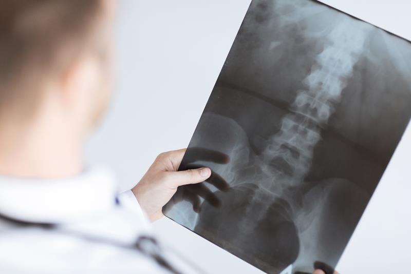 Chiropractor reviewing patient X-ray during exam