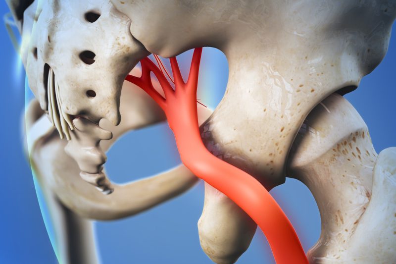 Lower back pain radiating to leg from sciatica