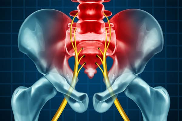 Lower back pain radiating to leg from sciatica